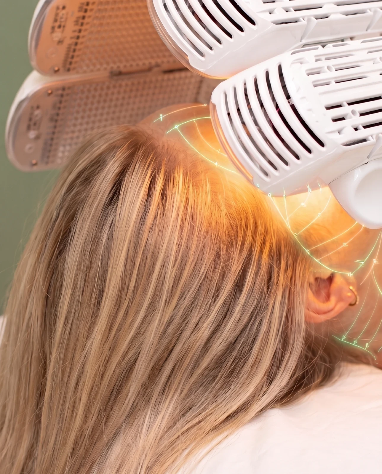 Rood licht therapie Terneuzen - LED behandeling tegen acne, roodheid en huidveroudering bij Team Vital