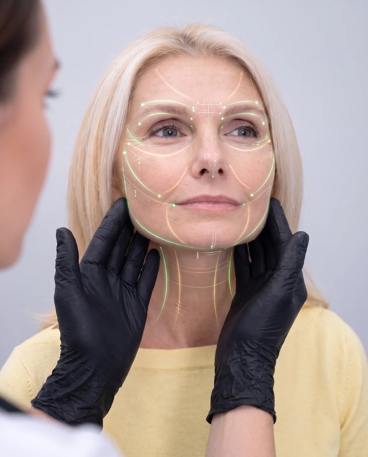 Botox Terneuzen - botox en fillers behandeling bij Team Vital, subtiel en natuurlijk resultaat