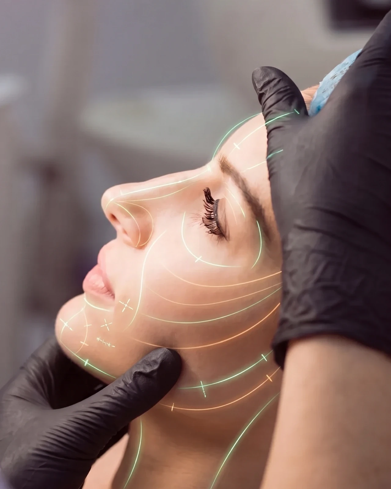 Plastische chirurgie Terneuzen - facelift en cosmetische ingrepen bij Team Vital